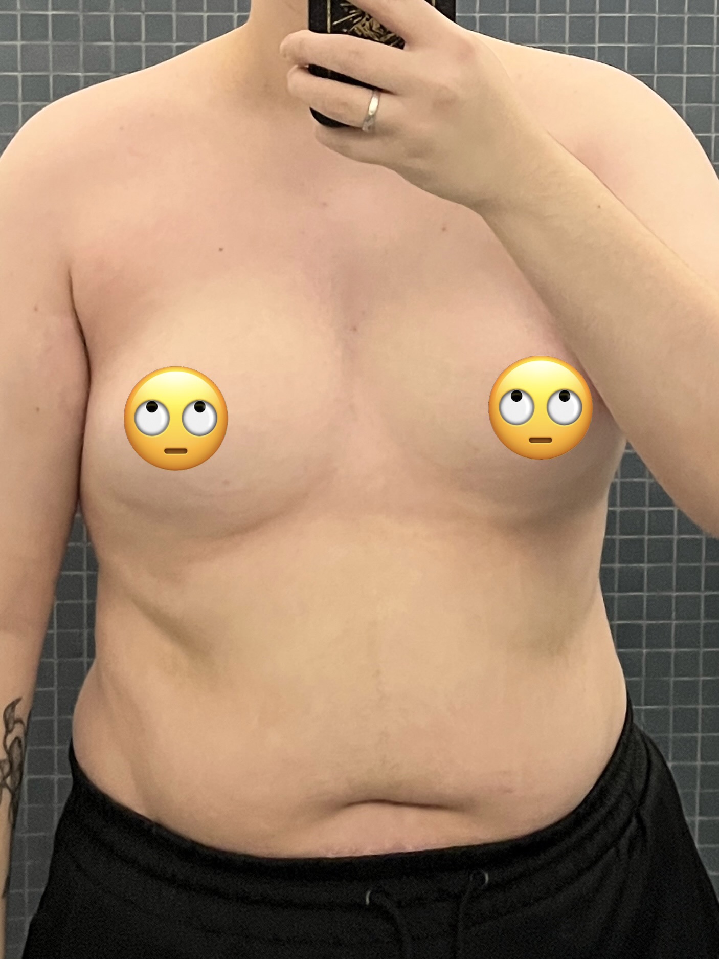 Trans man not wearing a shirt